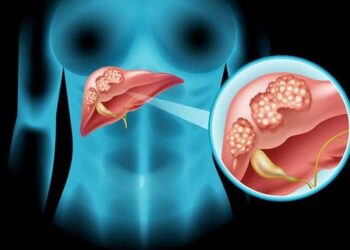 Dự báo tỷ lệ ung thư gan tăng cao vào năm 2040