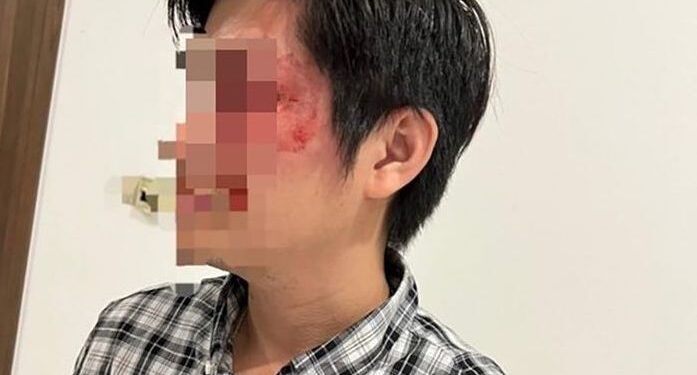 TS. Luật gia Hồ Minh Sơn: Chủ vật nuôi phải bồi thường thiệt hại nếu vi phạm về việc quản lý, nuôi nhốt, có thể bị truy cứu trách nhiệm hình sự vì hành hung người cha bảo vệ con