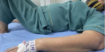 Sức khỏe giảm sút sau khi uống thuốc được quảng cáo “chữa bách bệnh” mua trên mạng