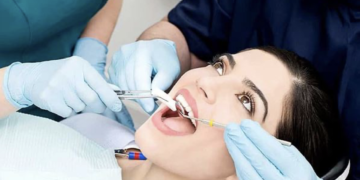 Đi nhổ răng có được bảo hiểm y tế chi trả?