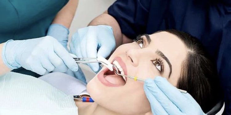 Đi nhổ răng có được bảo hiểm y tế chi trả?